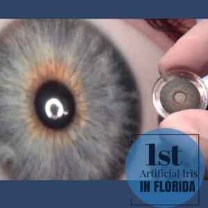 First Artificial Iris