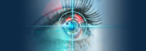 Laser Cataract Surgery in Boca Raton, Davie, Miami, Palm Beach, Plantation, and Weston